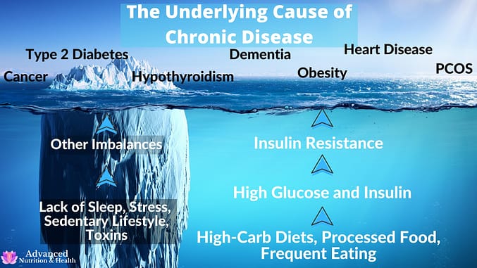 Elevated Glucose and Insulin are the Root Cause of Chronic Diseases.