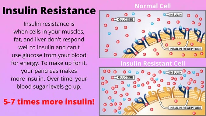 Insulin Resistance vs Insulin Sensitivity.