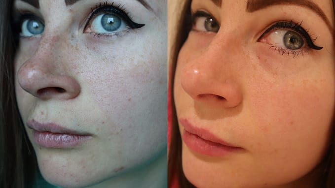 WildMint Cosmetics: Before and After Photos.